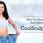 What Should You Know About Coolsculpting?