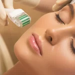 know about microneedling 600x350