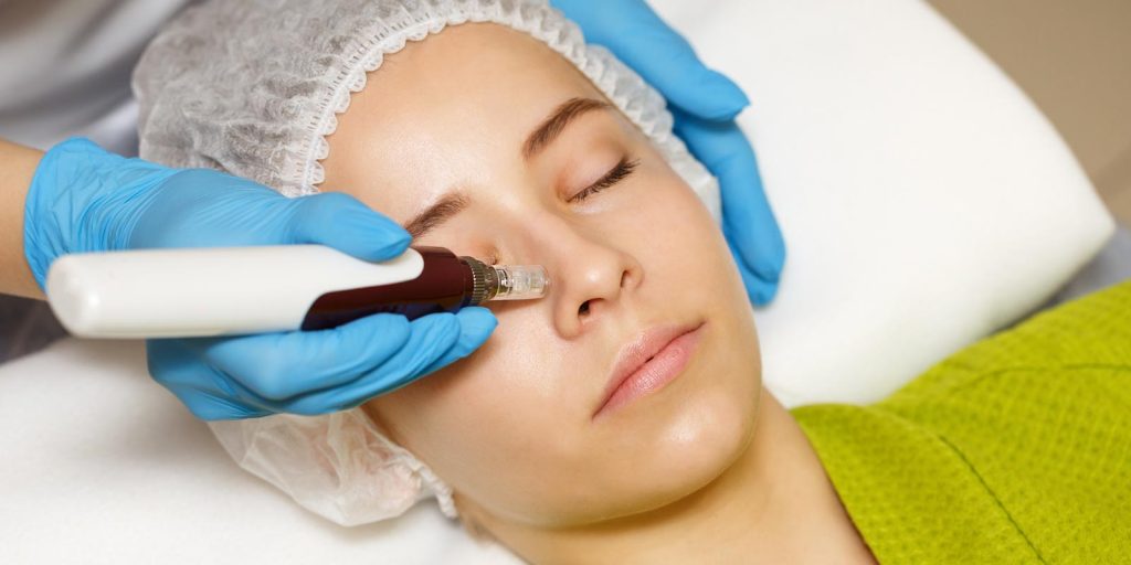 person-getting-professional-microneedling