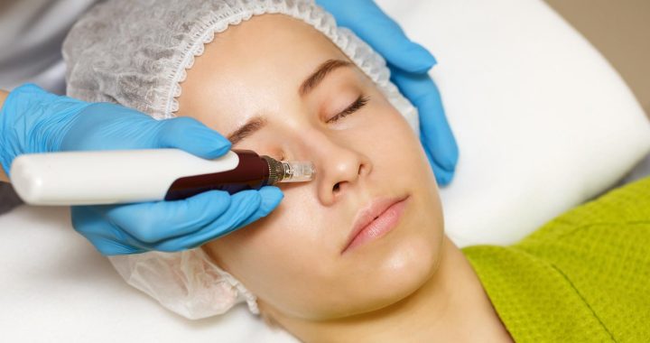 person-getting-professional-microneedling
